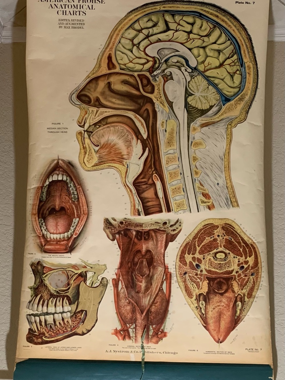 Antique American Frohse Anatomical Chart Head and Neck Signed Max Brotel 1919 - Picture 2 of 16